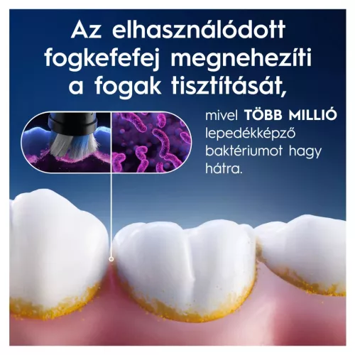 Oral-B 10PO010458 Series Gentle Care fogkefefej 4 db.